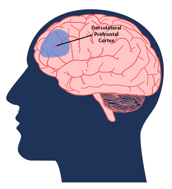 Image of brain showing the dorsolateral prefrontal cortex location